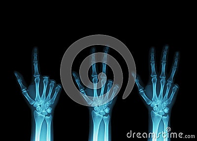 x-ray-fingers-9121351.jpg