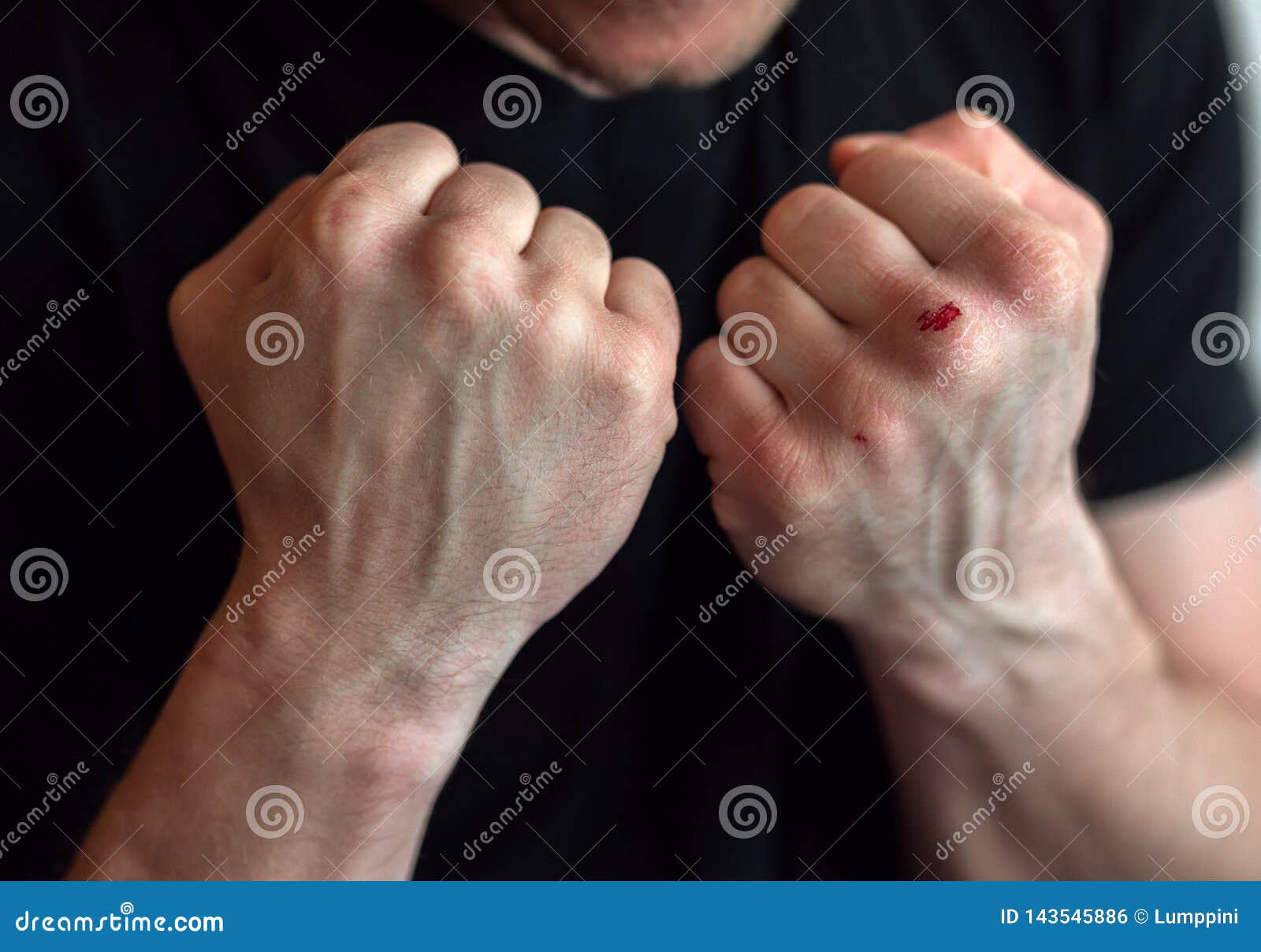 boxing-fists-blood-close-up-motivation-boxing-fists-blood-close-up-motivation-boxing-143545886.jpg