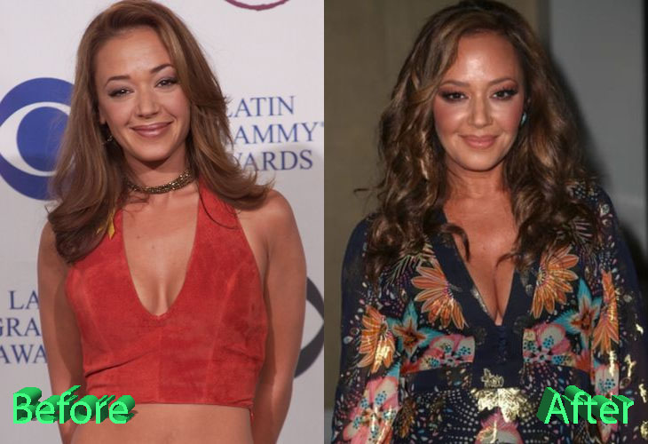 Leah-Remini-Before-and-After-Plastic-Surgery.jpg