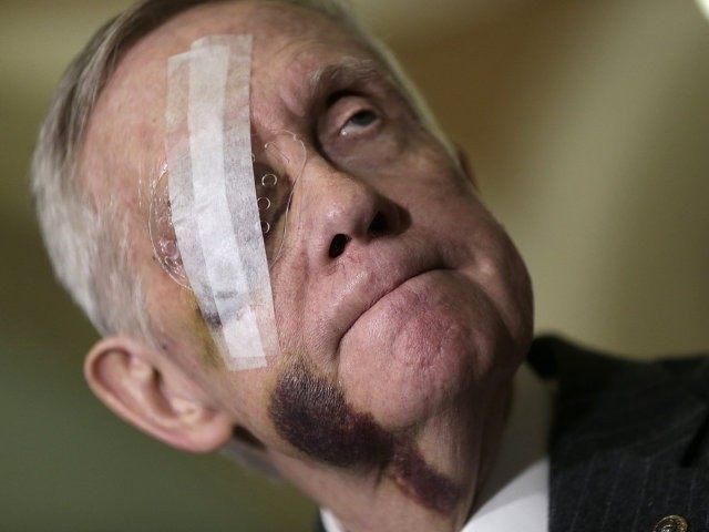 harry-reid-bruises-afp.jpg